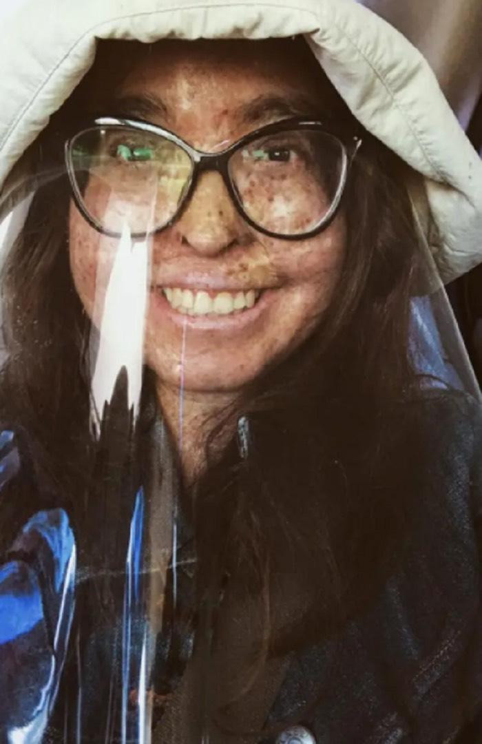 Dù trời có mây, mưa thì Andrea cũng phải mặc áo dài tay, đội mũ và che mặt. Dù trời có mây, mưa thì Andrea cũng phải mặc áo dài tay, đội mũ và che mặt.