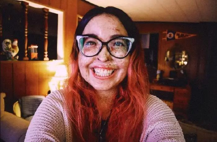 Căn bệnh hiếm gặp khiến cuộc sống của Andrea Ivonne Monroy bị ví như ma cà rồng. Căn bệnh hiếm gặp khiến cuộc sống của Andrea Ivonne Monroy bị ví như ma cà rồng.