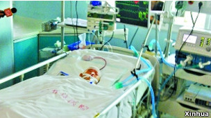 Bé Duyệt Duyệt đang trong tình trạng hôn mê tại phòng bệnh