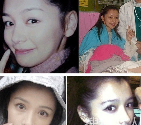 Từ Nhược Tuyên