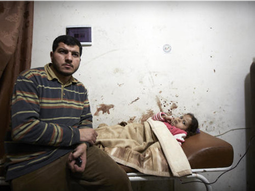 Vô số trẻ em bị thương... Ảnh: AP