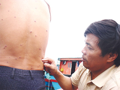 Lưng ngư dân Lê Quang Tư dính đầy vết đạn hoa cải