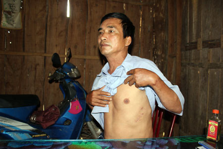 Án tình tay ba, ông lão 60 trút 'mưa dao' đòi vợ ảnh 2