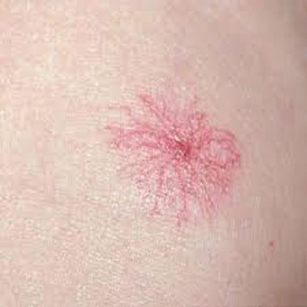 Những dấu hiệu bệnh nguy hiểm từ gan không thể ngờ ảnh 1