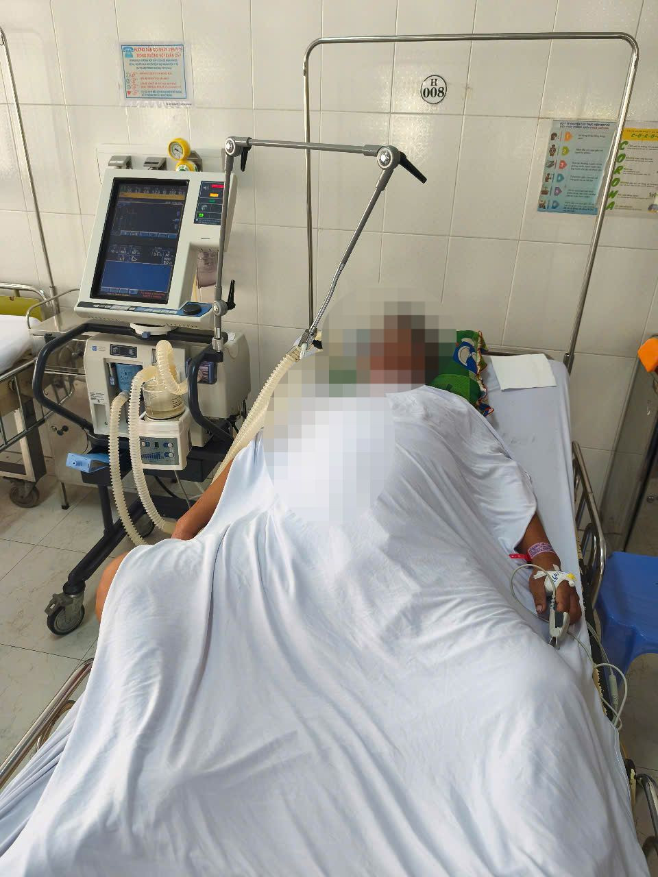 Một bệnh nhân ngộ độc cá nóc đang điều trị thở máy tại Bệnh viện Đa khoa Cái Nước.
