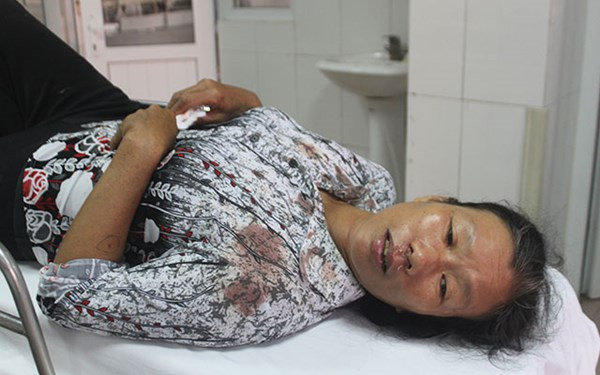 Lời kể hãi hùng của nạn nhân vụ xe khách đối đầu xe tải ảnh 2