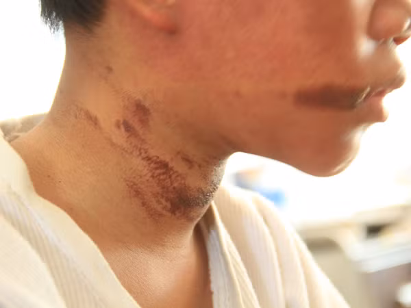 Bé T tại Bệnh viên