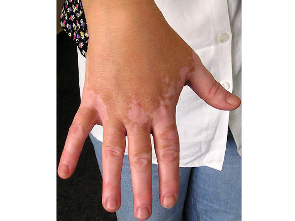 Điều gì xảy ra nếu bạn uống sữa khi ăn thịt gà? ảnh 1