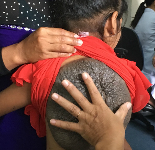 Những căn bệnh lạ lần đầu xuất hiện ở Việt Nam ảnh 1