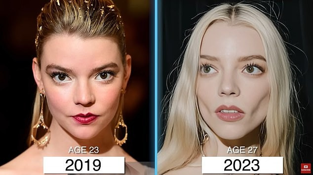 Anya Taylor-Joy trông hốc hác hơn xưa, nhưng cũng có thể do giảm cân. Anya Taylor-Joy trông hốc hác hơn xưa, nhưng cũng có thể do giảm cân.