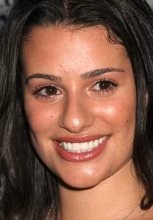 Lea Michele có dấu hiệu má hóp đặc trưng của việc trải qua thủ thuật loại bỏ mỡ má. Lea Michele có dấu hiệu má hóp đặc trưng của việc trải qua thủ thuật loại bỏ mỡ má.