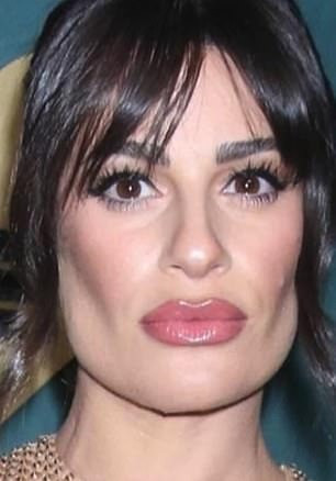 Lea Michele có dấu hiệu má hóp đặc trưng của việc trải qua thủ thuật loại bỏ mỡ má. Lea Michele có dấu hiệu má hóp đặc trưng của việc trải qua thủ thuật loại bỏ mỡ má.