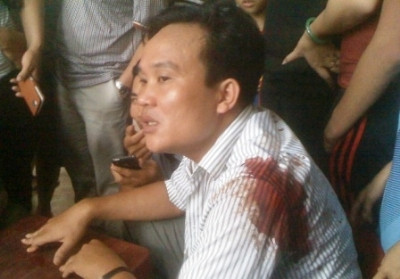 Mới đây nhất CSGT Thanh Hóa đã nổ súng bắn người tham gia giao thông là Anh Lê Văn Ngọc. Mới đây nhất CSGT Thanh Hóa đã nổ súng bắn người tham gia giao thông là Anh Lê Văn Ngọc