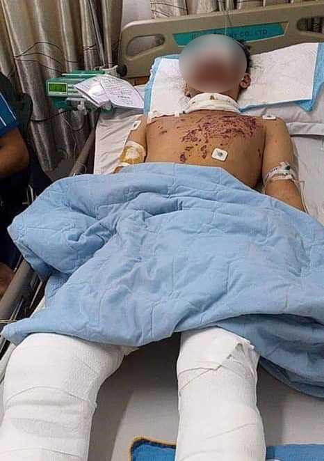 Học cách chế tạo mìn qua mạng, 4 người trọng thương ảnh 2