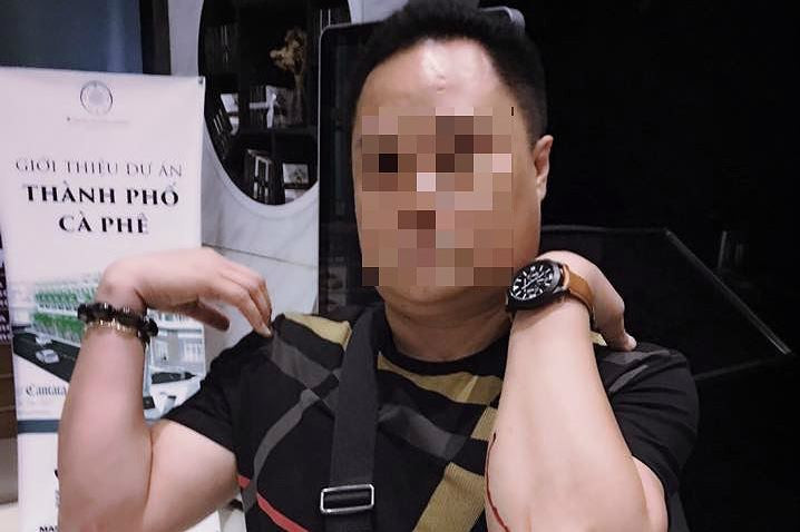 Tình tiết mới vụ máy bay Vietjet bị rơi 2 bánh ảnh 3