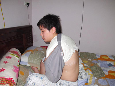 Nguyễn Hoài Linh phải bó bột sau khi va chạm với lực lượng làm nhiệm vụ