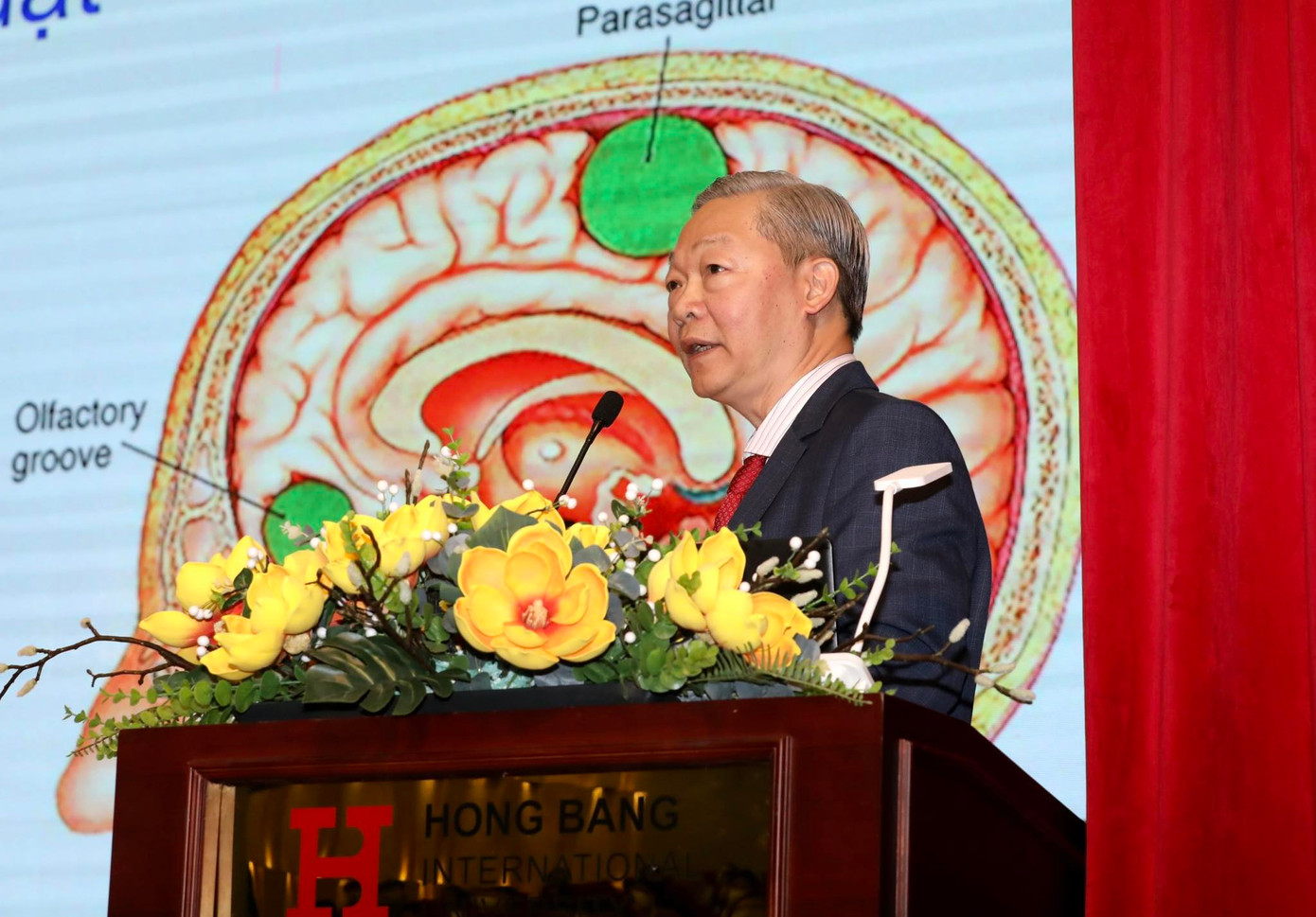 ThS. BS. CKII Chu Tấn Sĩ, Trưởng khoa Ngoại Thần kinh, Trung tâm Thần kinh, Bệnh viện Đa khoa Tâm Anh TPHCM.