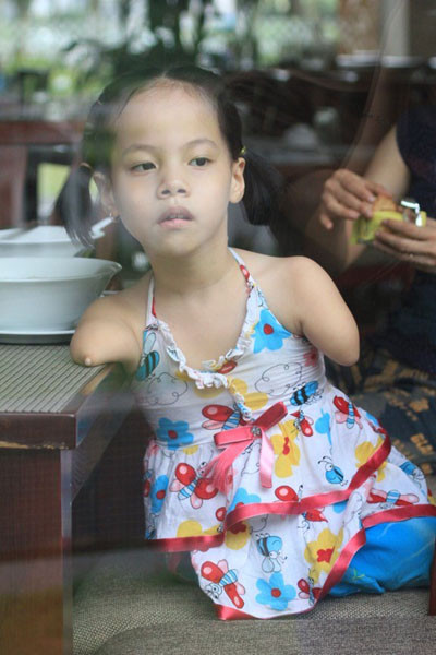 Linh Chi luôn háo hức, vì ước mơ được gặp Nick em đã ấp ủ từ lâu