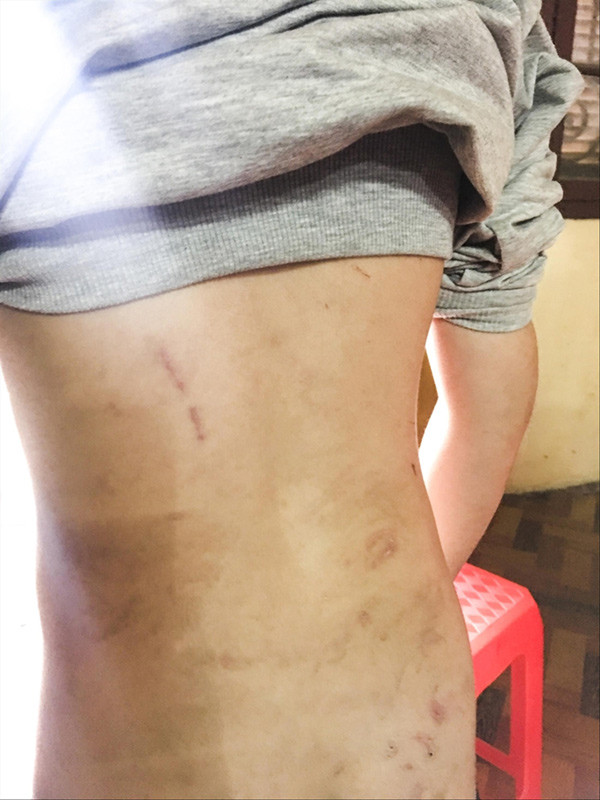 Bạo hành trẻ em: Bỏ ngay tư tưởng 'yêu cho roi cho vọt' ảnh 1