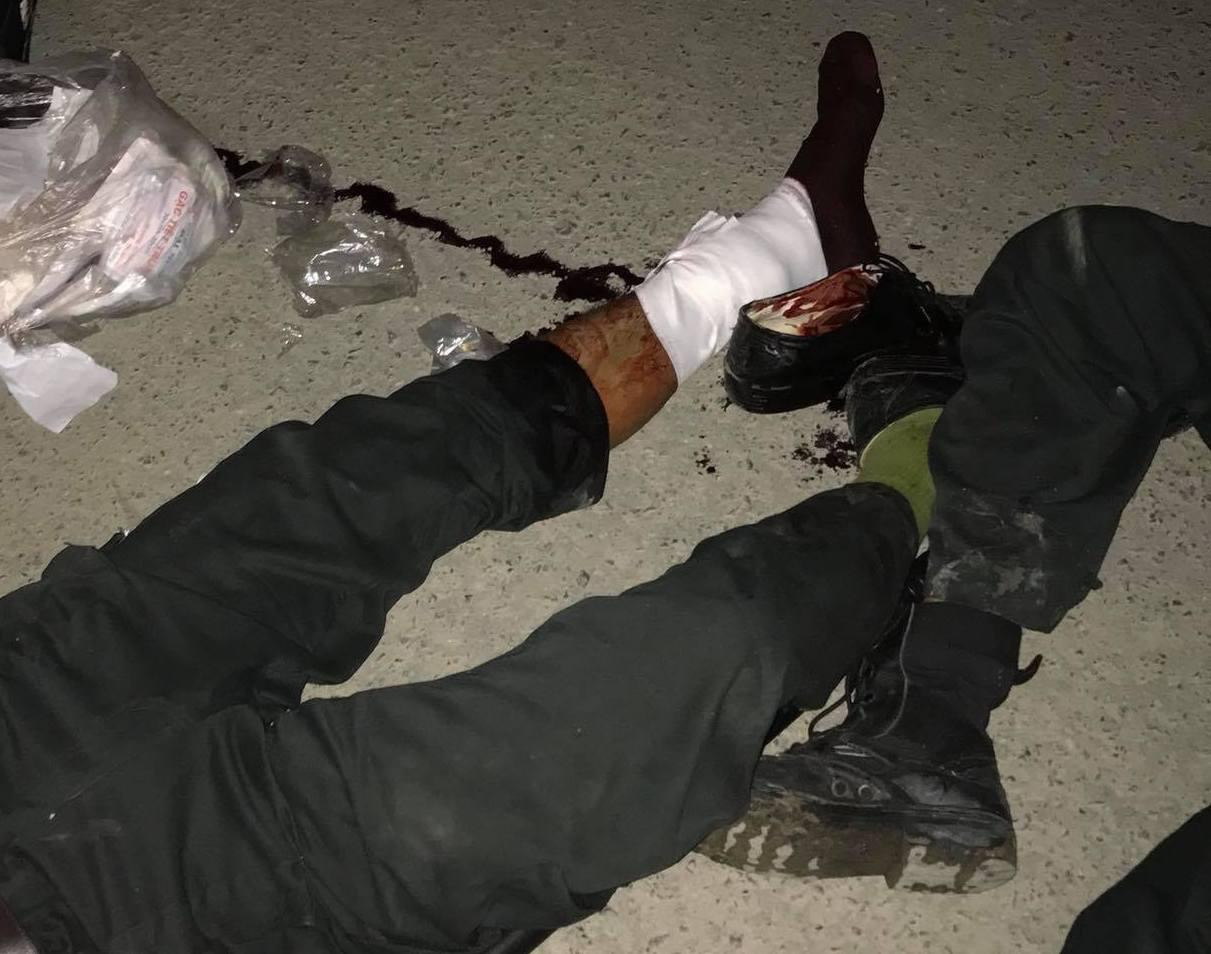 Công an bị thương do một số đối tượng quá khích hành hung.