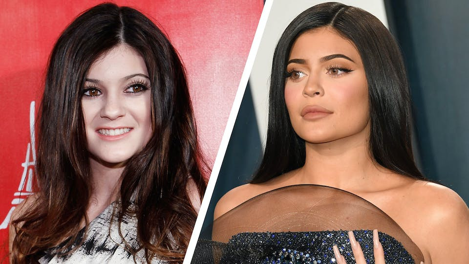 Gương mặt của Kylie Jenner trước và sau khi cô nổi tiếng.