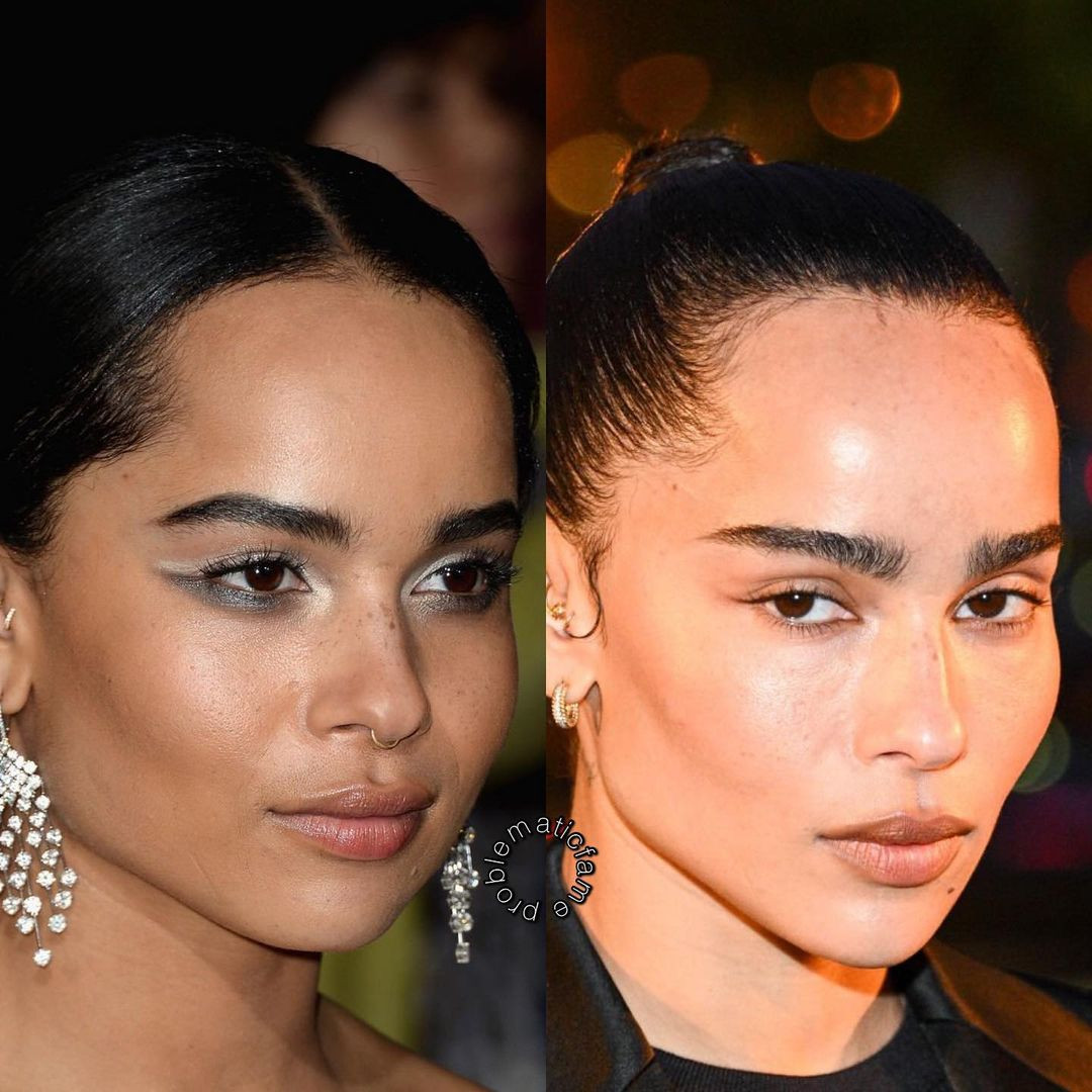 "Catwoman" Zoe Kravitz từng có đôi má bầu bĩnh trước khi trở nên sắc sảo, góc cạnh. "Catwoman" Zoe Kravitz từng có đôi má bầu bĩnh trước khi trở nên sắc sảo, góc cạnh.