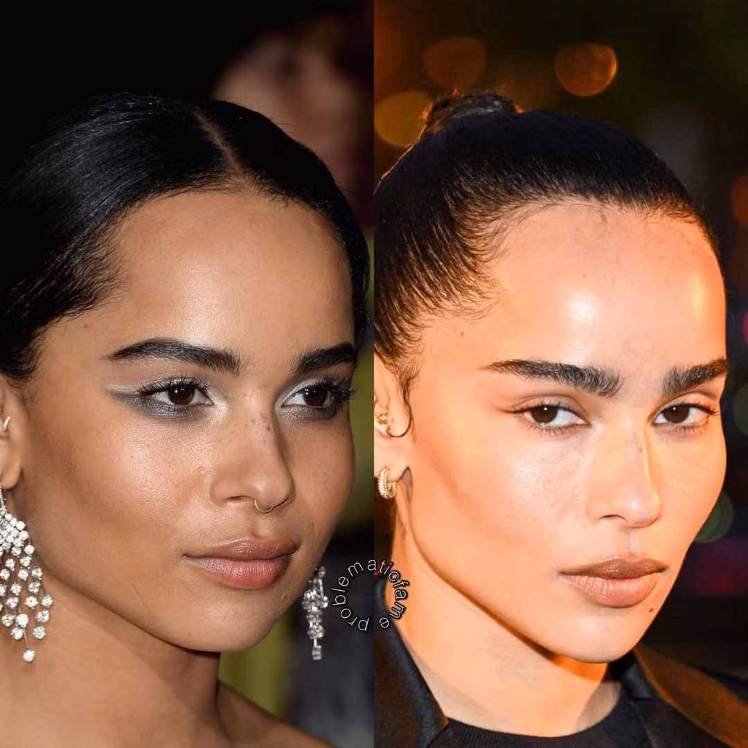 "Catwoman" Zoe Kravitz từng có đôi má bầu bĩnh trước khi trở nên sắc sảo, góc cạnh.