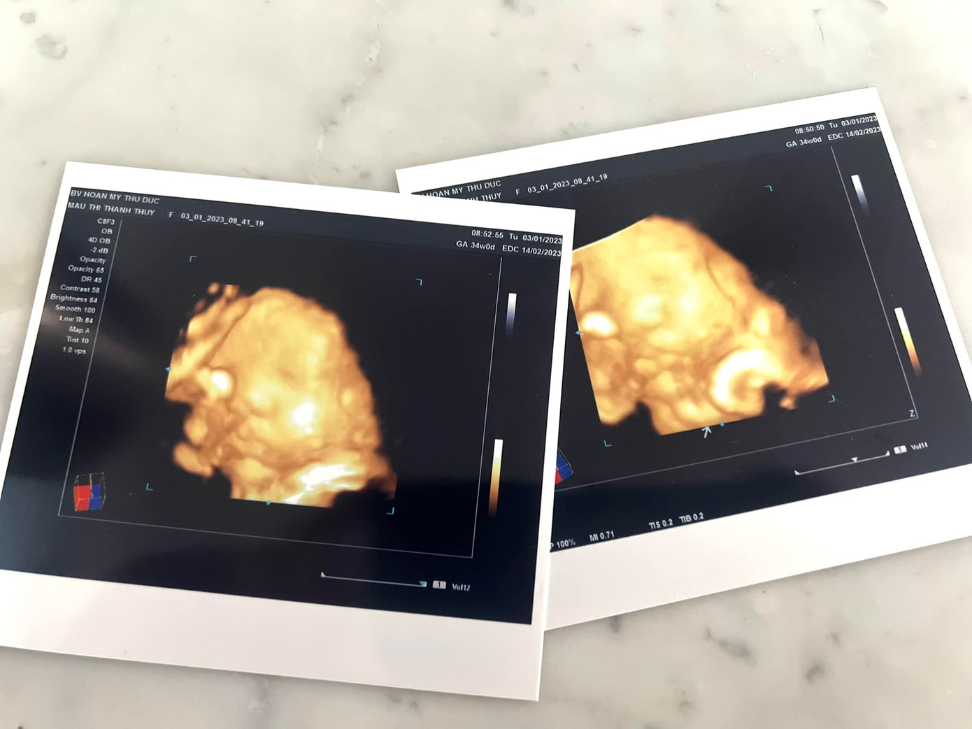 Nàng hậu cho biết thời gian sinh con có thể sẽ sớm hơn dự kiến. Nàng hậu cho biết thời gian sinh con có thể sẽ sớm hơn dự kiến.