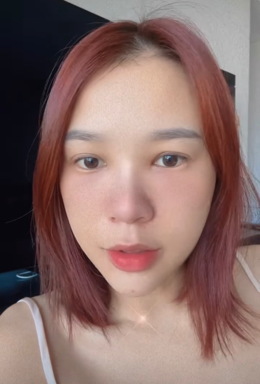 Sự cố sức khỏe khiến gương mặt của Sam bị sưng to bất thường. Sự cố sức khỏe khiến gương mặt của Sam bị sưng to bất thường.