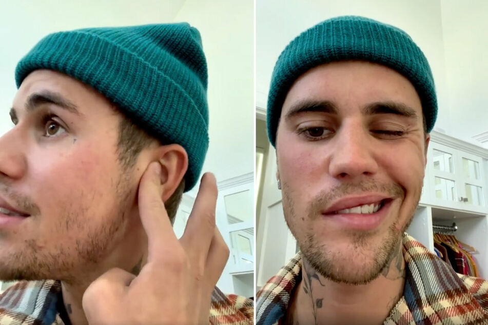 Năm ngoái, Justin Bieber từng khiến người hâm mộ bàng hoàng khi tiết lộ bản thân mắc hội chứng Ramsay Hunt, khiến nửa mặt bị liệt và không thể nháy mắt hoặc cười. Năm ngoái, Justin Bieber từng khiến người hâm mộ bàng hoàng khi tiết lộ bản thân mắc hội chứng Ramsay Hunt, khiến nửa mặt bị liệt và không thể nháy mắt hoặc cười.