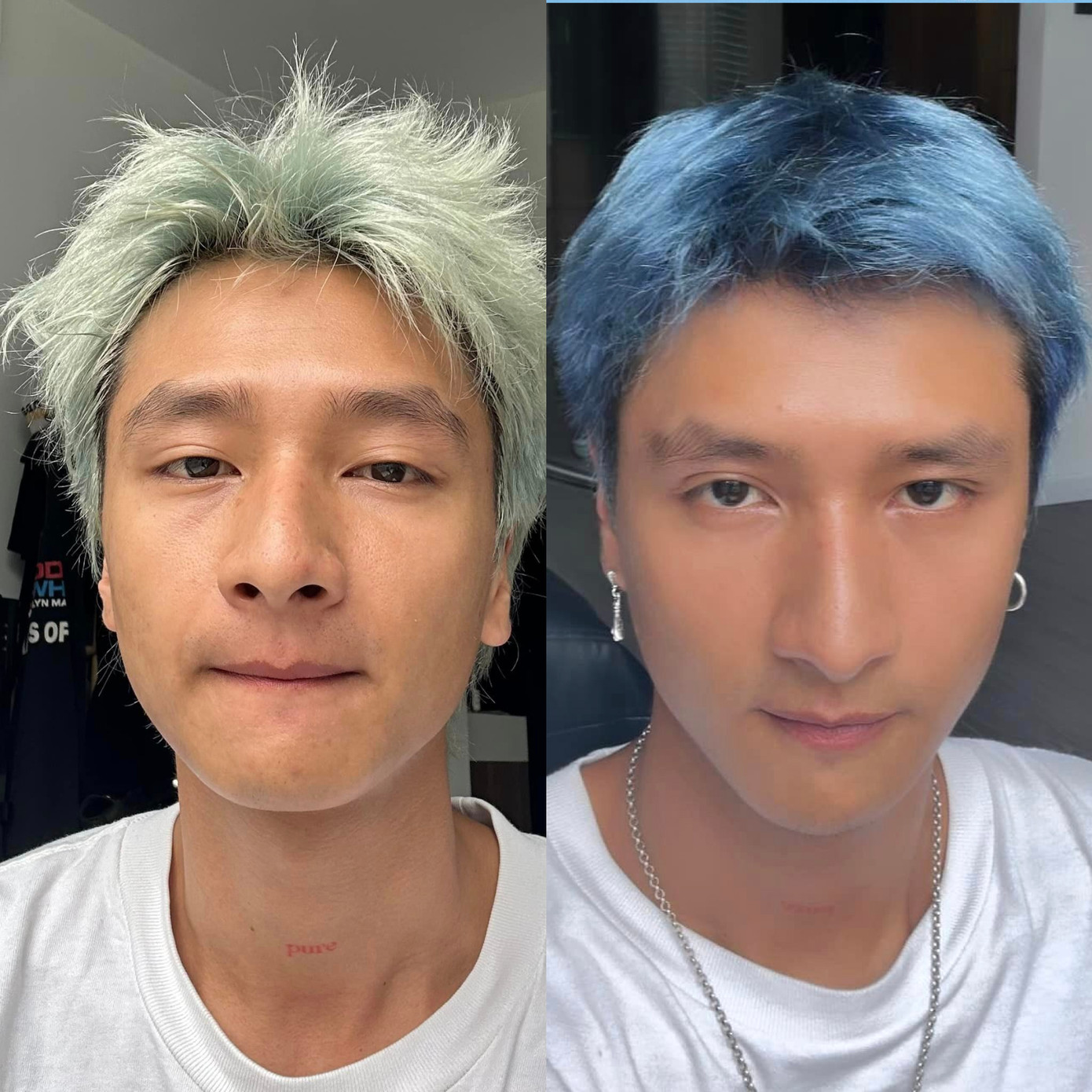 Hình ảnh của nam ca sĩ trong thời gian anh đối mặt với các vấn đề về tâm lý.