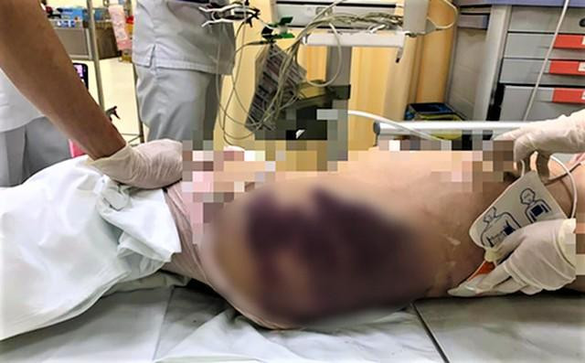 Báo tin trẻ bị xâm hại, bạo hành là trách nhiệm của mỗi công dân - Ảnh 4.