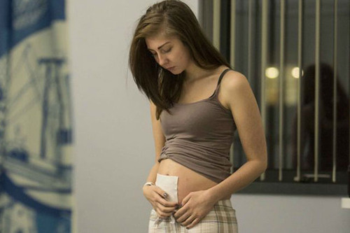 Rachael Harley cảm thấy tồi tệ và mệt mỏi với căn bệnh kỳ lạ