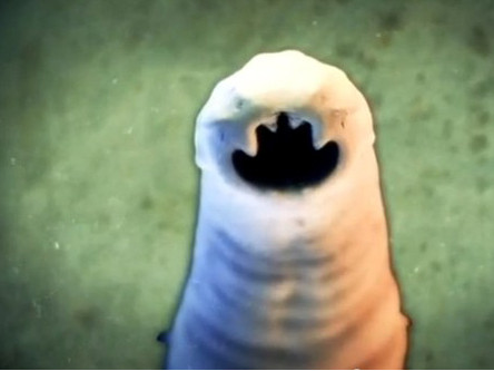 Giun móc trong cơ thể người