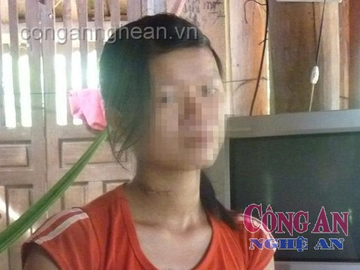 Vết thương trên cổ chị Nghiệp vẫn chưa lành