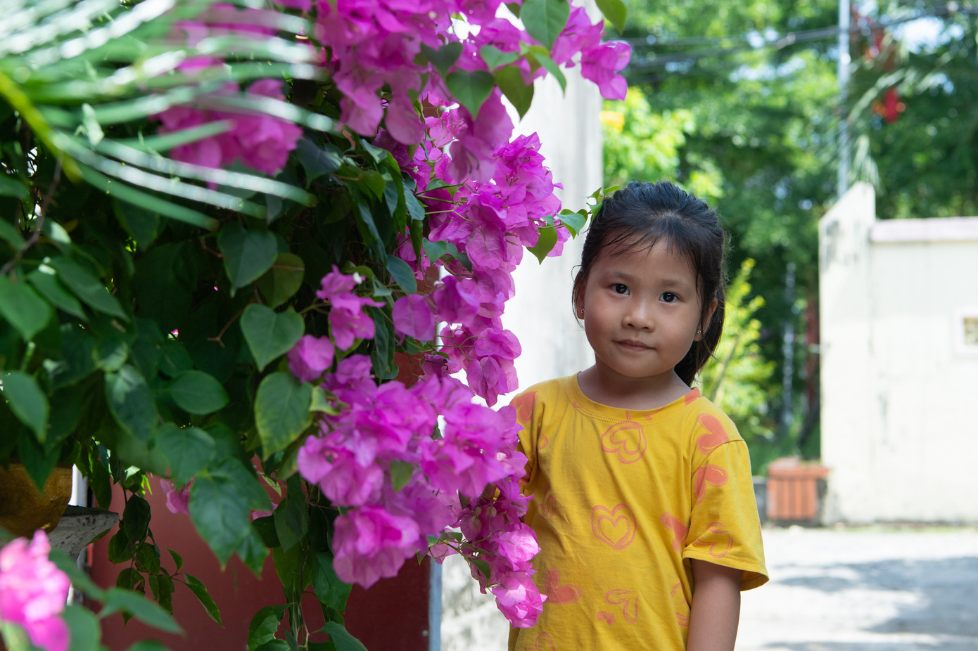 2 năm trước, Trâm Anh trải qua một cuộc phẫu thuật lớn, chữa trị dị tật bẩm sinh ở tim. Khi mới chào đời, vùng ngực của em đã nhô cao bất thường, có thể nhìn rõ bằng mắt thường 2 năm trước, Trâm Anh trải qua một cuộc phẫu thuật lớn, chữa trị dị tật bẩm sinh ở tim. Khi mới chào đời, vùng ngực của em đã nhô cao bất thường, có thể nhìn rõ bằng mắt thường