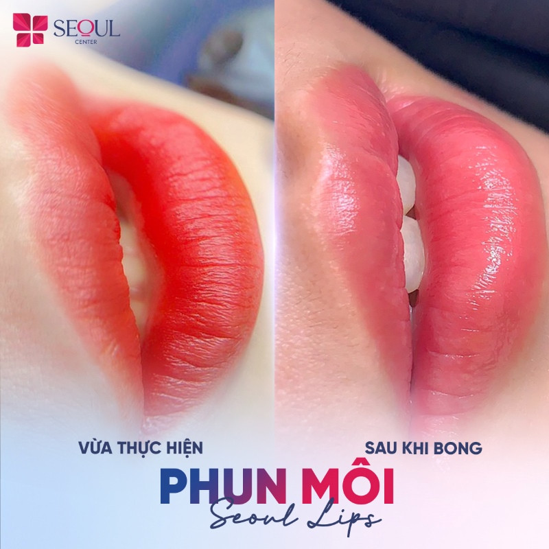 Seoul Center là địa chỉ phun môi với nhiều công nghệ độc quyền hiện đại được chuyển giao trực tiếp từ Hàn Quốc Seoul Center là địa chỉ phun môi với nhiều công nghệ độc quyền hiện đại được chuyển giao trực tiếp từ Hàn Quốc