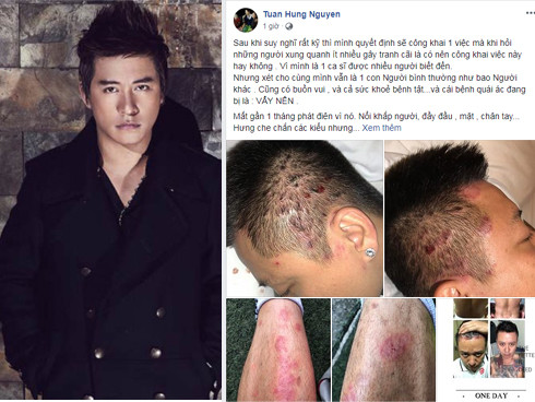 Showbiz 22/6: Tuấn Hưng suy sụp vì bị bệnh 'khó lòng chữa khỏi' ảnh 5