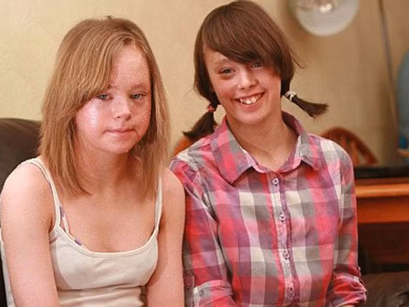 Stacey, 16 tuổi, và Emma, 18 tuổi, đã phải vượt qua nhiều trở ngại trong quá trình chung sống với chứng bệnh da liễu hiếm gặp