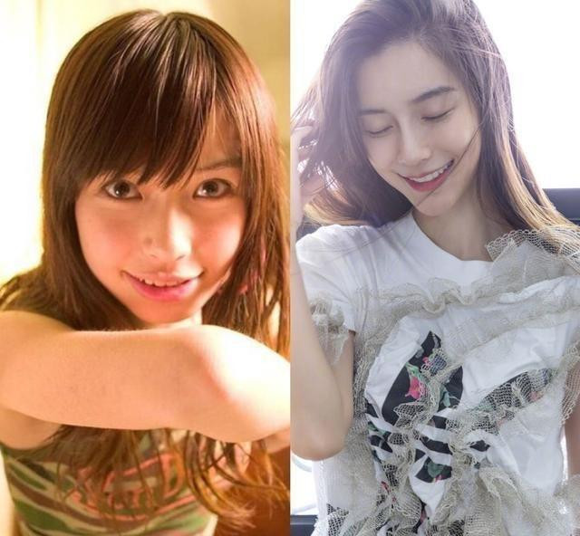 Angelababy trước và sau khi niềng răng. Angelababy trước và sau khi niềng răng.