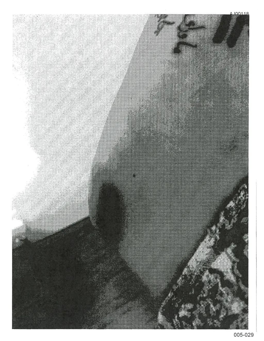 Bản in đen trắng những bức ảnh được cho là chụp thương tích của Angelina Jolie. Bản in đen trắng những bức ảnh được cho là chụp thương tích của Angelina Jolie.