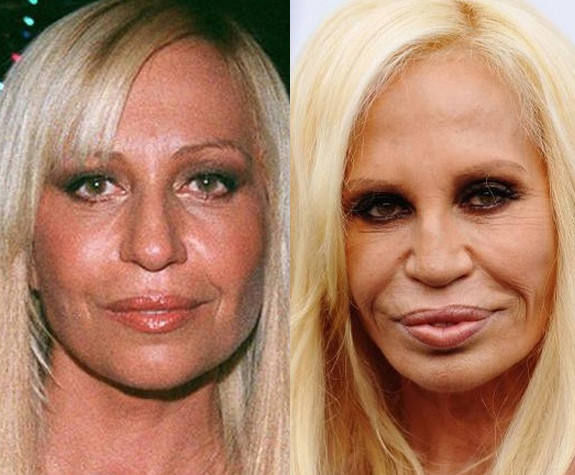 Donatella Versace - nữ hoàng thời trang xấu xí