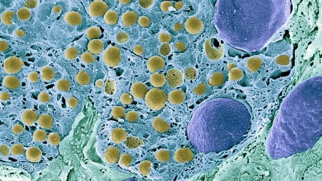 Hình ảnh kính hiển vi điện tử quét của các tế bào tuyến tụy. (Ảnh: Thư viện ảnh khoa học - STEVE GSCHMEISSNER)