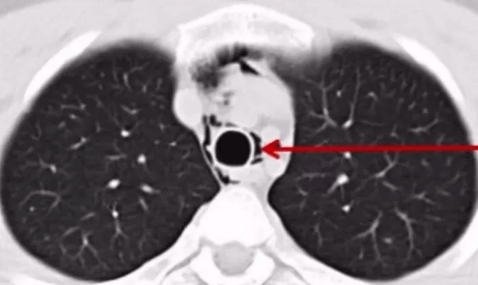 Hy vọng khán giả xem BLACKPINK sẽ không có ai lâm vào tình cảnh trớ trêu nói trên. Hy vọng khán giả xem BLACKPINK sẽ không có ai lâm vào tình cảnh trớ trêu nói trên.