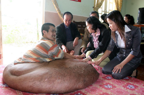 Anh Hải được nhiều người thăm hỏi động viên lúc mang khối u khổng lồ