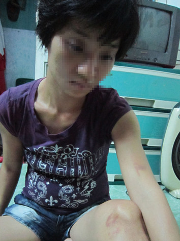 Bức ảnh do người dân chụp lại lúc chị Trúc bị chồng đánh vào tháng 7/2013