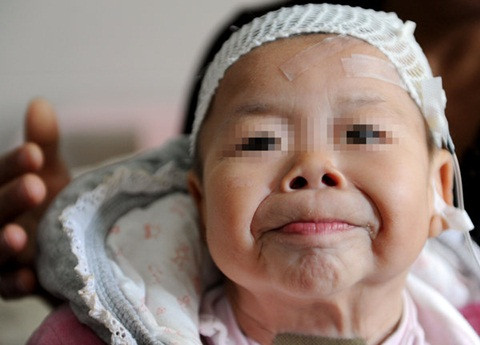 Bé Hinh đáng thương 