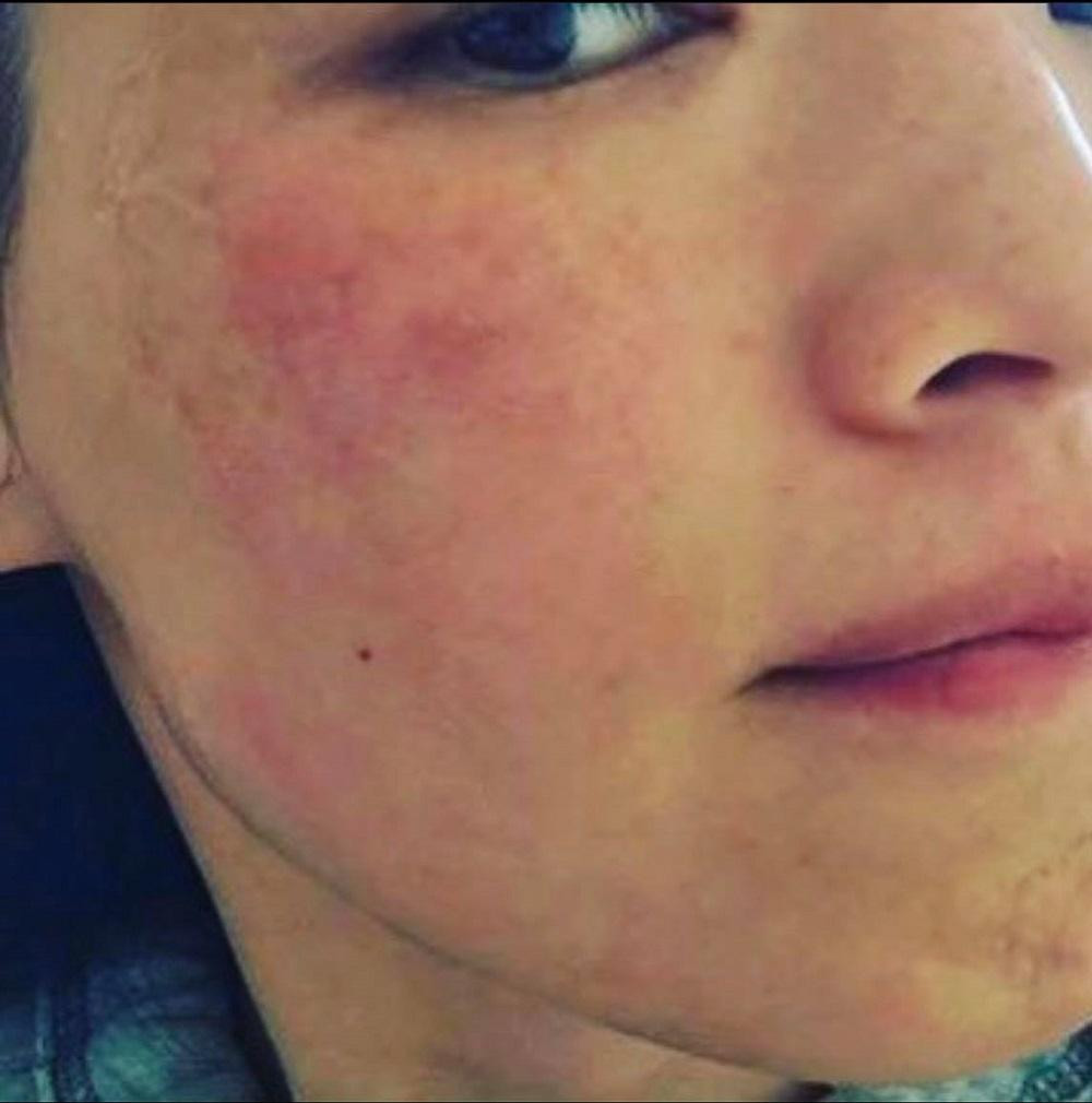 “Mỗi vết tàn nhang đều có câu chuyện của riêng nó…” “Mỗi vết tàn nhang đều có câu chuyện của riêng nó…”