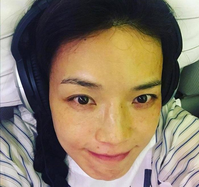 "Không có những nốt tàn nhang đó, thì không có tôi của hiện tại..." "Không có những nốt tàn nhang đó, thì không có tôi của hiện tại..."