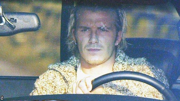 Vết rách trên đuôi mắt Beckham được cho là do Alex Ferguson đá bay giày vào mặt.